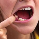 sonhar com dente caindo