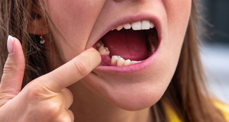 Sonhar com Dente Caindo: O Que Esse Sonho Revela Sobre Você 69 sonhar com dente caindo